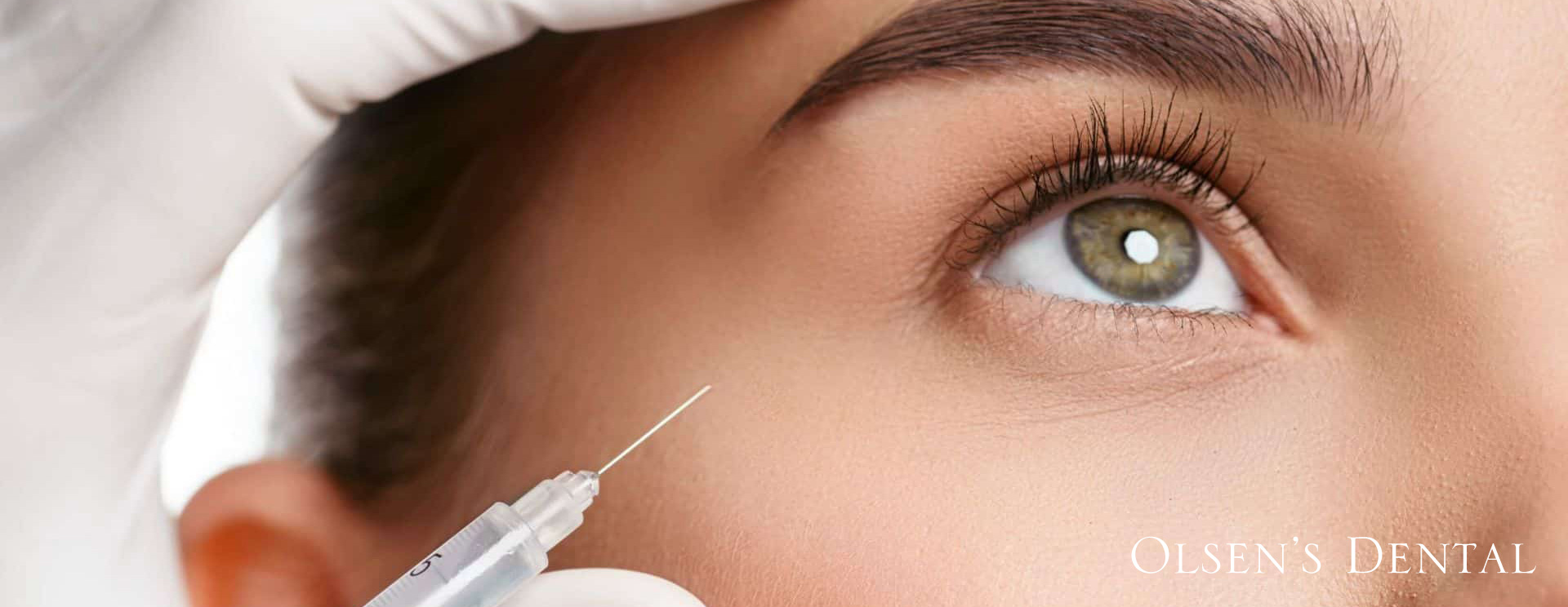 botox Anti Wrinkle treatment